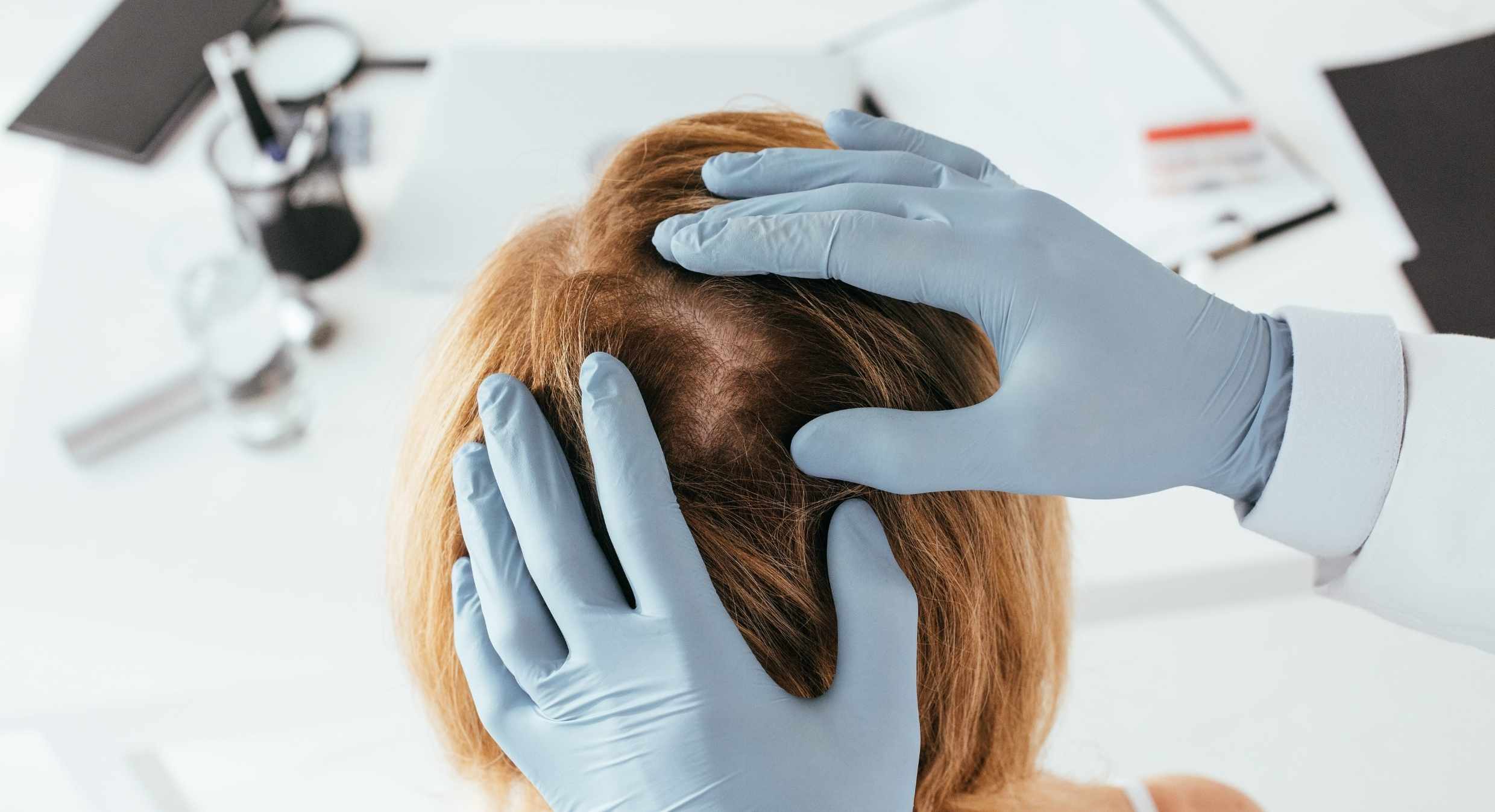 Propecia kaufen in der Schweiz