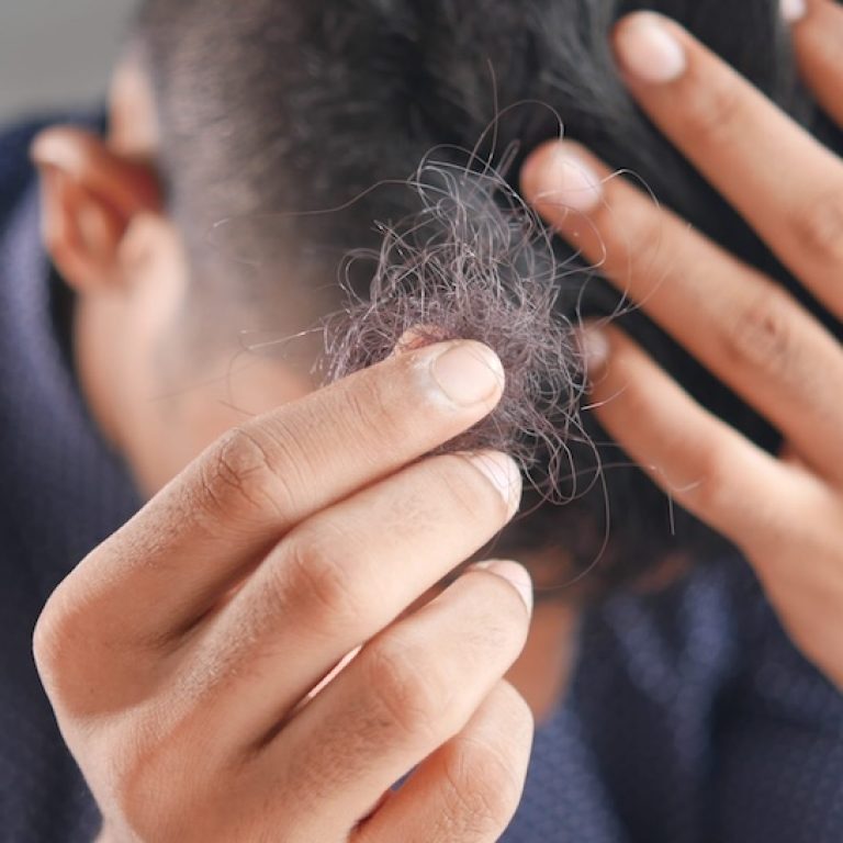 Propecia kaufen in Österreich