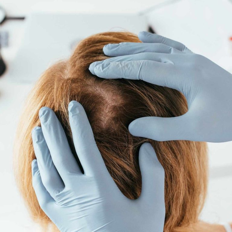 Propecia kaufen in der Schweiz